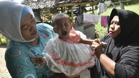 Bukan Manfaat, Sunat Perempuan Malah Beri Efek Buruk
