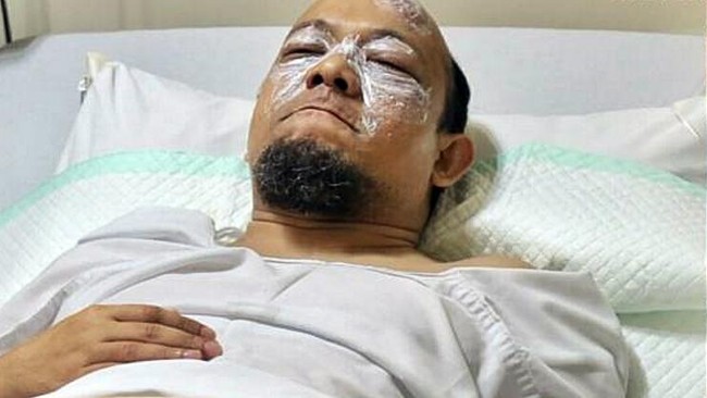 Novel terkena siraman air keras pada wajah, mata dan tangan. Dokter memfokuskan penanganan pada mata dengan operasi pembersihan sisa cairan air keras.