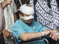 Dokter Cari Alternatif Penyembuhan Mata Kiri Novel Baswedan