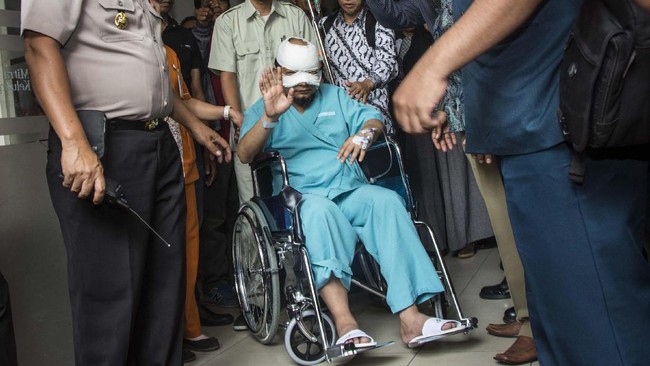 Lensa kontak mata Penyidik KPK Novel Baswedan sempat beberapa kali terlepas karena mendapat tekanan dari lapisan luar.