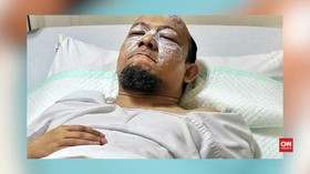 Novel Berobat ke Singapura untuk Sembuhkan Mata