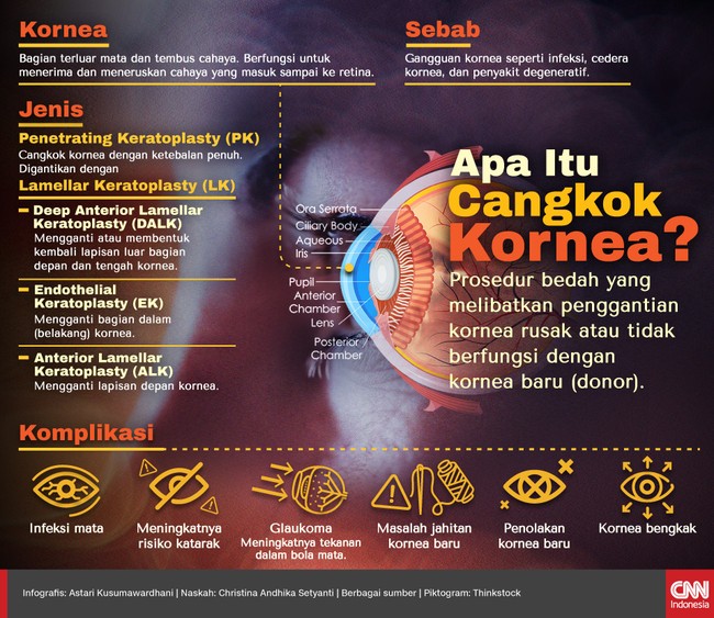 Penglihatan dapat berkurang karena gangguan kornea seperti infeksi dan cedera. Untuk mengembalikan penglihatan perlu cangkok kornea.