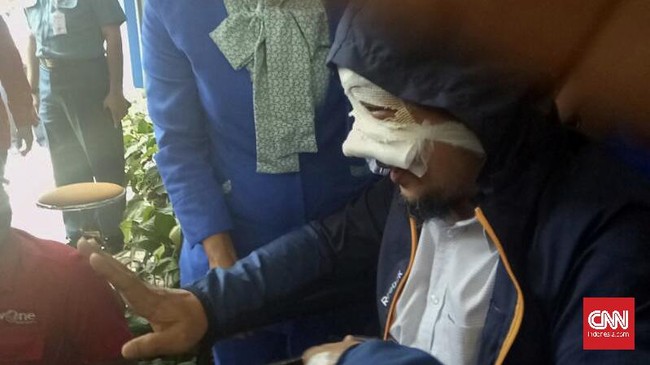 Dokter di rumah sakit tempat Novel berobat, Jakarta Eye Center, mengklaim kondisi Novel mengalami perbaikan signifikan dibandingkan Selasa kemarin. 