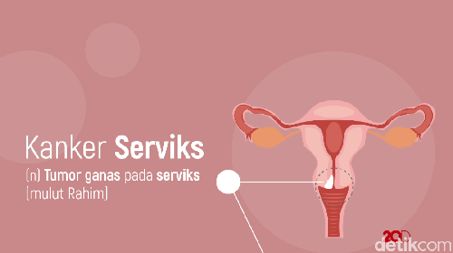 Periksa Kanker Serviks Gratis di RSON Cibubur Periksa Kanker Serviks Gratis di RSON Cibubur