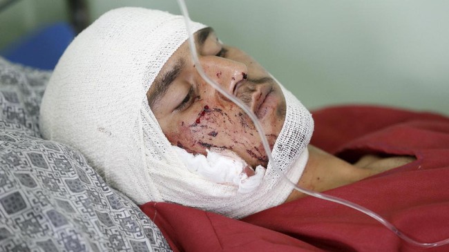 Dampak Serangan Bom Bunuh Diri dekat Kedubes AS di Kabul