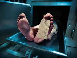 Misteri Kematian Pendiri Playboy, Disebut gegara Bakteri Agresif Kebal Antibiotik