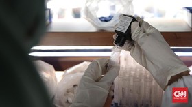 Divonis Rp2 M usai Uji Formalin Bocor, Nakes Sulsel Minta Perlindungan