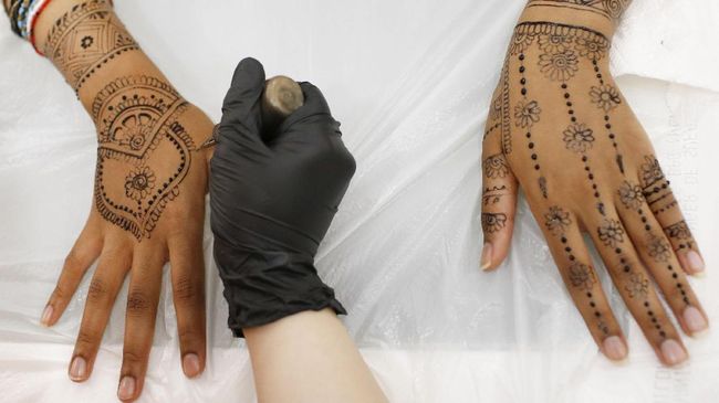 Karena aplikasi tato henna, kulit jari sampai lengan seorang anak tujuh tahun melepuh sesuai dengan pola tato henna hitam. Bekas lukanya terancam permanen.