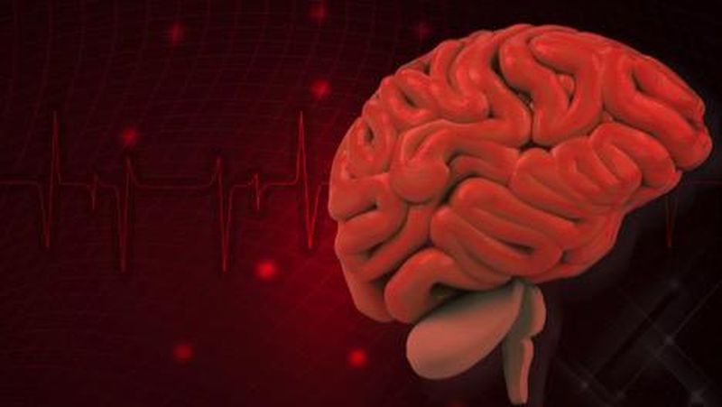 Penanganan stroke sangat bergantung pada waktu. Semakin cepat penanganannya, tingkat kesembuhan semakin baik.
