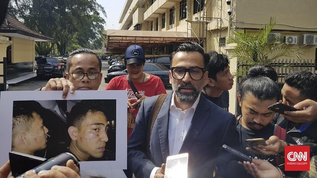 Aksi penganiayaan oleh oknum polisi dalam memburu pengakuan terduga seperti yang dialami putra artis peran Jeremy Thomas, Axel, bukan hal baru.