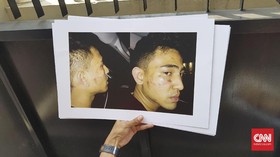 Cerita Axel Matthew Thomas ke Ibunda: Matt Salah Apa, Ma?