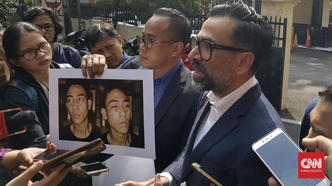 Jeremy Thomas menyebut ada anggota polisi yang bertanya soal aset kepada anaknya,Axel Matthew Thomas, saat menyidik perkara kepemilikan narkotik.