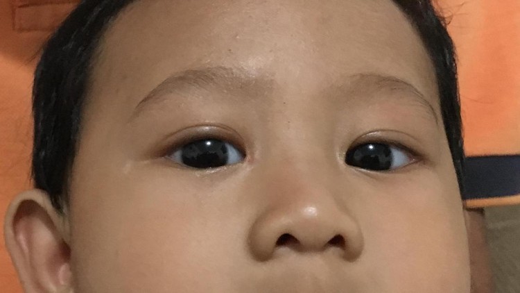 Cekrek! Bayi difoto, tapi kameranya pakai flash nih. Duh, matanya aman nggak ya?