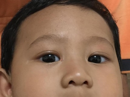 Mata Bayi Kena Flash Kamera, Aman Nggak Ya?