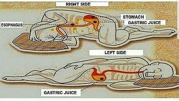 Miring atau Telentang? Ini Posisi Tidur yang Baik untuk Kesehatan Menurut Dokter
