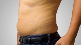 Seniman Sulap Stretch Mark dan Menstruasi Jadi Karya Seni