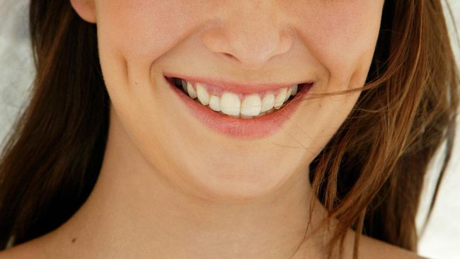 Tren operasi plastik mulai berubah ke arah 'melubangi' wajah untuk menciptakan lesung pipi. Lesung pipi dianggap membuat wajah terlihat manis dan menggemaskan.