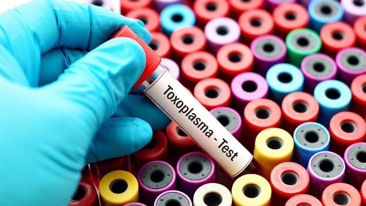 Toksoplasma bisa picu penyakit, baik pada janin atau orang dewasa. Tapi kalau kita sehat sih sebenarnya nggak berdampak apa-apa, Bun.