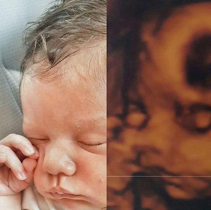 <div>Mirip nggak Bun saat bayi ini masih di rahim bundanya dan setelah dia lahir? (Foto: Instagram /@healthy.pregnancy via @pregnancygram_)</div><div> </div>