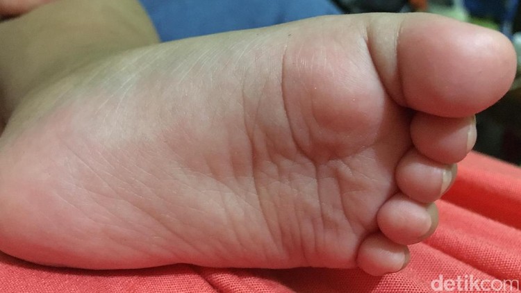 Kenang-kenangan ketika si kecil lahir bisa jadi 'alat' untuk mendeteksi adanya kelainan pada tubuhnya.