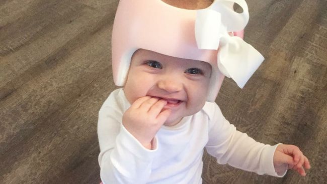 Melihat bayi memakai helm khusus di kepala mungkin membuat sebagian orang tua bertanya-tanya. Apakah ini benar-benar perlu, atau hanya tren semata?