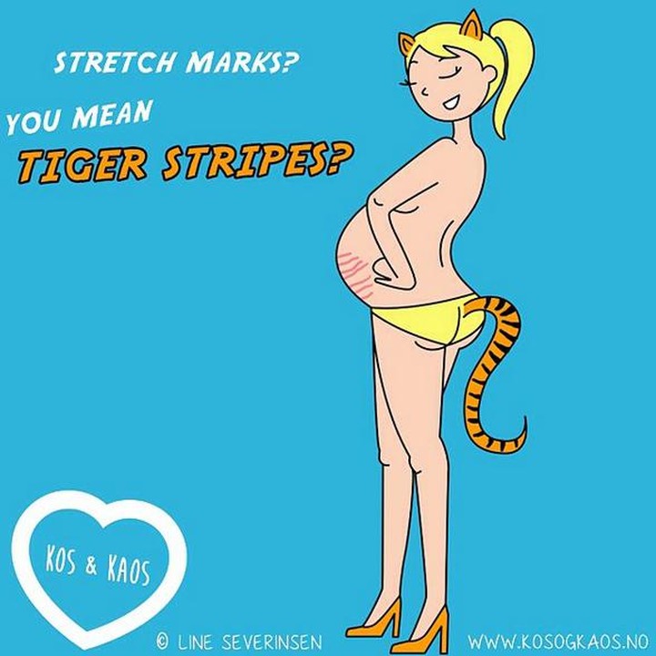 <div>Bukan lagi stretch mark tapi tiger stripes. Setuju nggak, Bun? (Foto: Instagram/@kosogkaos)</div><div> </div>