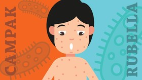 Kenali Bahaya dan Pencegahan Campak dan Rubella