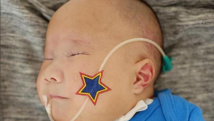 Adam Fabumi, Bayi dengan Trisomy 13 Itu Meninggal Bayi yang lahir dengan trisomy 13 itu meninggal dunia di usianya yang masih 7 bulan.