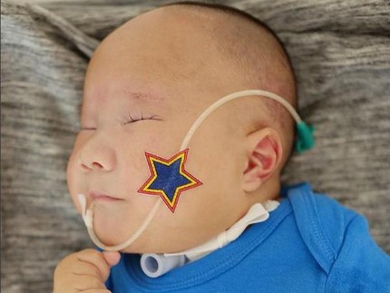 Adam Fabumi, Bayi dengan Trisomy 13 Itu Meninggal