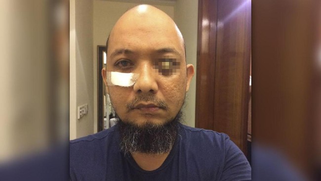 Penyidik KPK usai menjalani pemeriksaan polisi terkait laporan Aris Budiman terhadap Novel Baswedan. Informasi itu penting dan dapat dikembangkan.