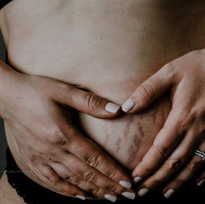 <p>Your body is not ruined, you're a tiger who earned her stripes. (Foto: Mikaela Shannon Photography)</p>
