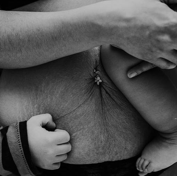 <p>Stretch mark ini menjadi semacam stempel, bahwa kami 'resmi' menjadi bunda. (Foto: Mikaela Shannon Photography)</p>