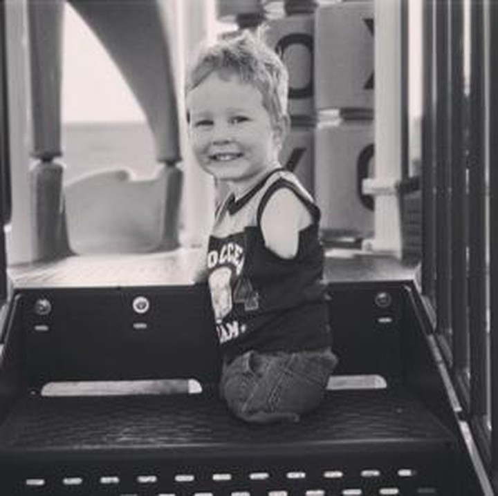 Camden lahir dengan sindrom phocomelia. Phocomelia adalah kelainan kongenital yang melibatkan malformasi anggota badan. Foto: Instagram/katiewhiddon