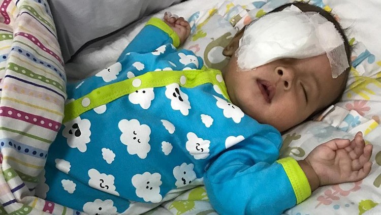 Katarak identik sama lansia. Tapi kondisi ini juga bisa terjadi pada bayi, lho.