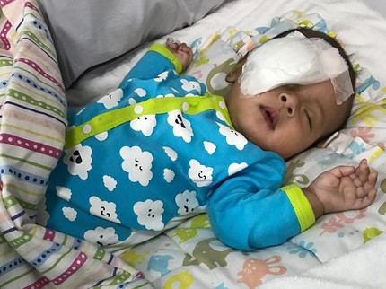 Apa Sih Penyebab Bayi Kena Katarak? Yuk Tanyakan ke Pak Dokter