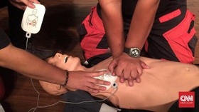 9 Langkah CPR Untuk Selamatkan Korban Henti Jantung Mendadak