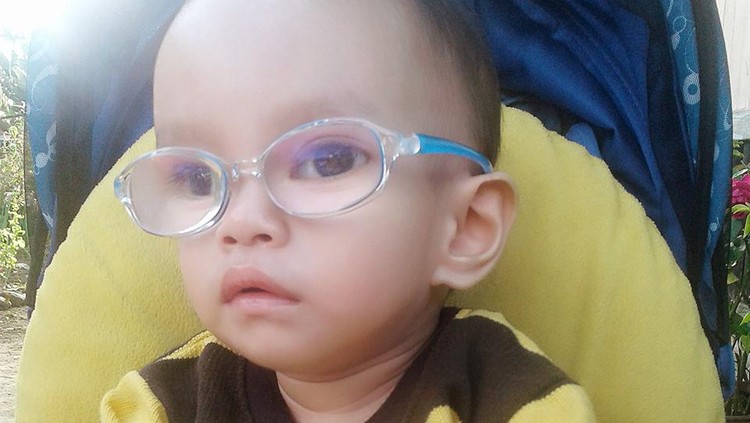 Jangan sampai katarak membuat dunia anak kita gelap selamanya.
