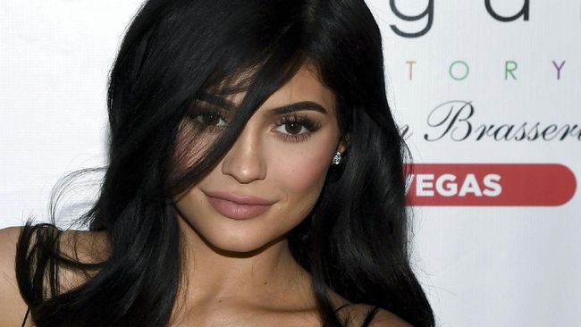 Bibir Kempis, Kylie Jenner Akui Tak Lagi Suntik Bibir