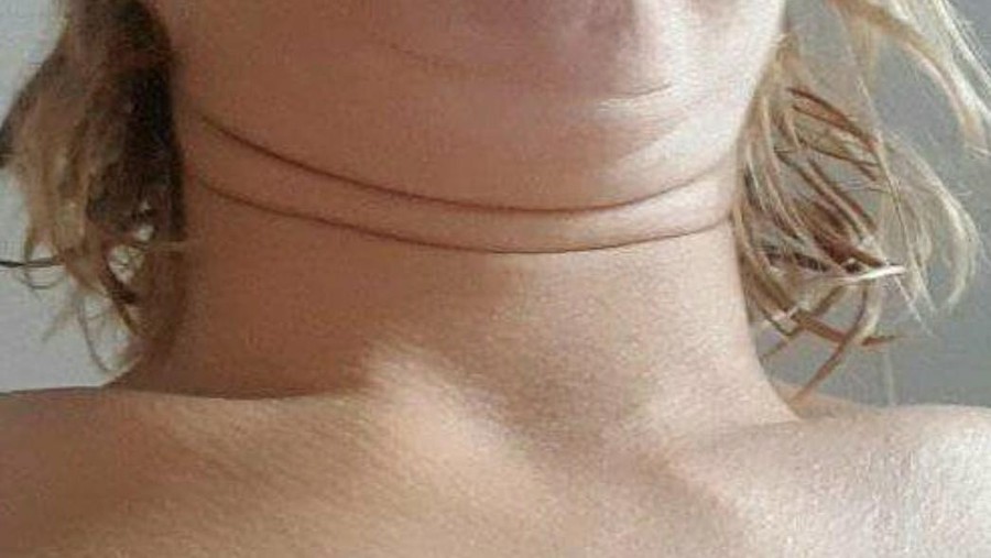 Pose dagu berlipat populer di instagram&period;