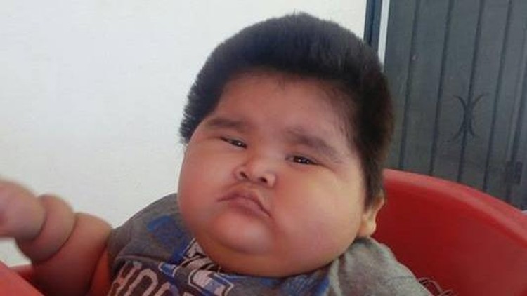 Umur 10 Bulan, Bayi Ini Beratnya Sama dengan Anak 9 Tahun Umurnya baru 10 bulan, tapi bobot bayi ini sama dengan rata-rata anak umur 9 tahun.