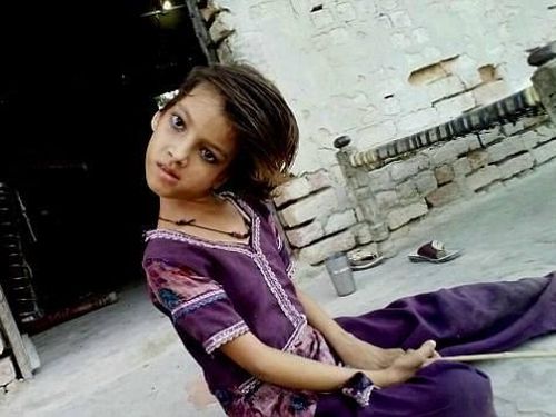 Penyakit Misterius Bikin Kepala Anak Ini Miring 90 Derajat Penyakit Misterius Bikin Kepala Anak Ini Miring 90 Derajat