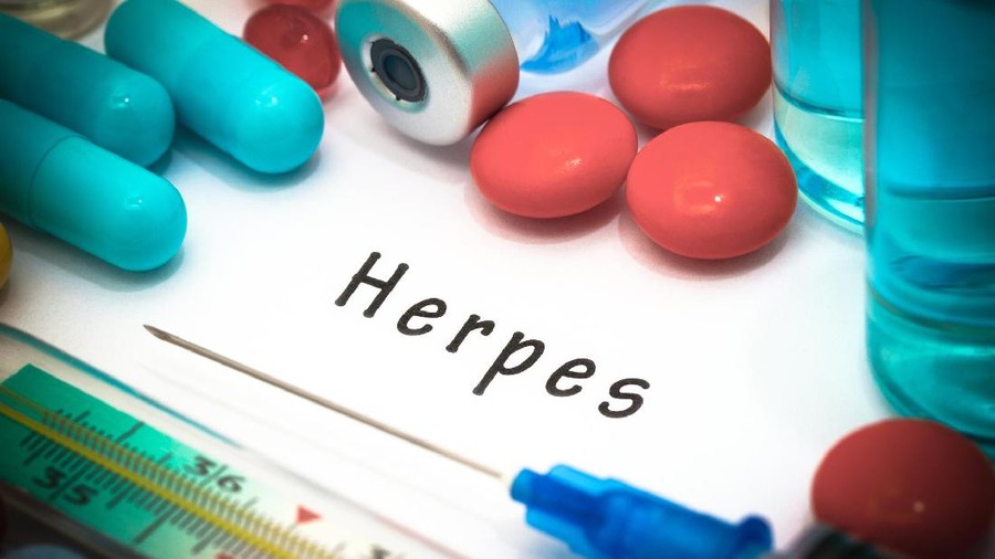 Herpes - diagnosis written on a white piece of paper. Syringe and vaccine with drugs.
