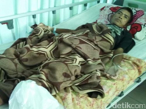 Kata Dokter THT Soal Kemungkinan Paku Tertelan ke Dalam Perut Kata Dokter THT Soal Kemungkinan Paku Tertelan ke Dalam Perut
