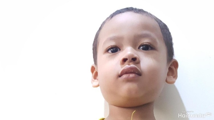 Saat anak kena gondongan, jangan dipaksa tetap masuk sekolah ya, Bun. Seisi sekolah bisa tertular.