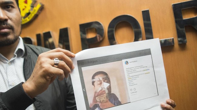 Kepastian sakit atau tidaknya Ketua DPR Setya Novanto dapat diketahui dari rekam medis di RS Premier yang dapat diminta oleh penegak hukum.