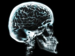 Wanita Ini Sering Nyeri di Pipi, Dikira Stres Ternyata Tumor Otak