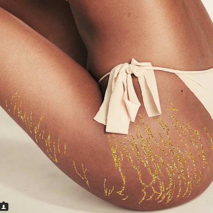 <p>Stretch mark yang kadang timbul di bokong jangan sampai 'merenggut' kepercayaan diri kita ya, Bun. (Foto: Instagram/ @sarashakeel)</p>