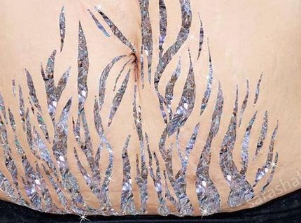Foto: Cantiknya 'Penampakan' Stretch Mark