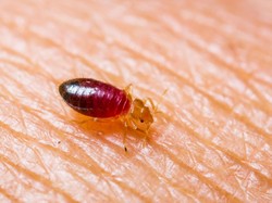 Tick-Borne dan Pes, Penyakit yang Mewabah di China di Masa Pandemi Corona