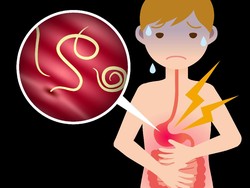 Daftar Obat Cacing Ampuh untuk Anak dan Dewasa